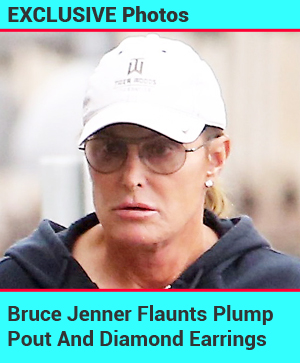Bruce Jenner Debuts Plump Pout And Diamond Earrings