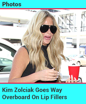 Kim Zolciak's Lips Are Insane